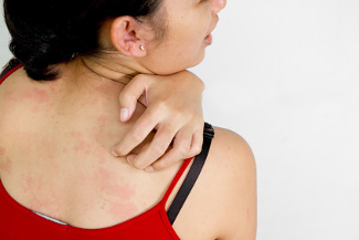 Remedies For Itchy Skin