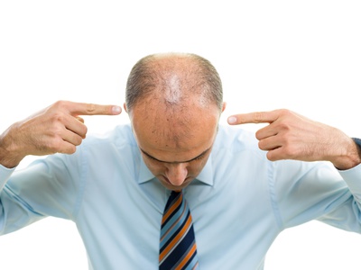 Should I Use Propecia For Hair Loss?