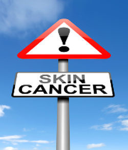 Watch For Signs of Melanoma